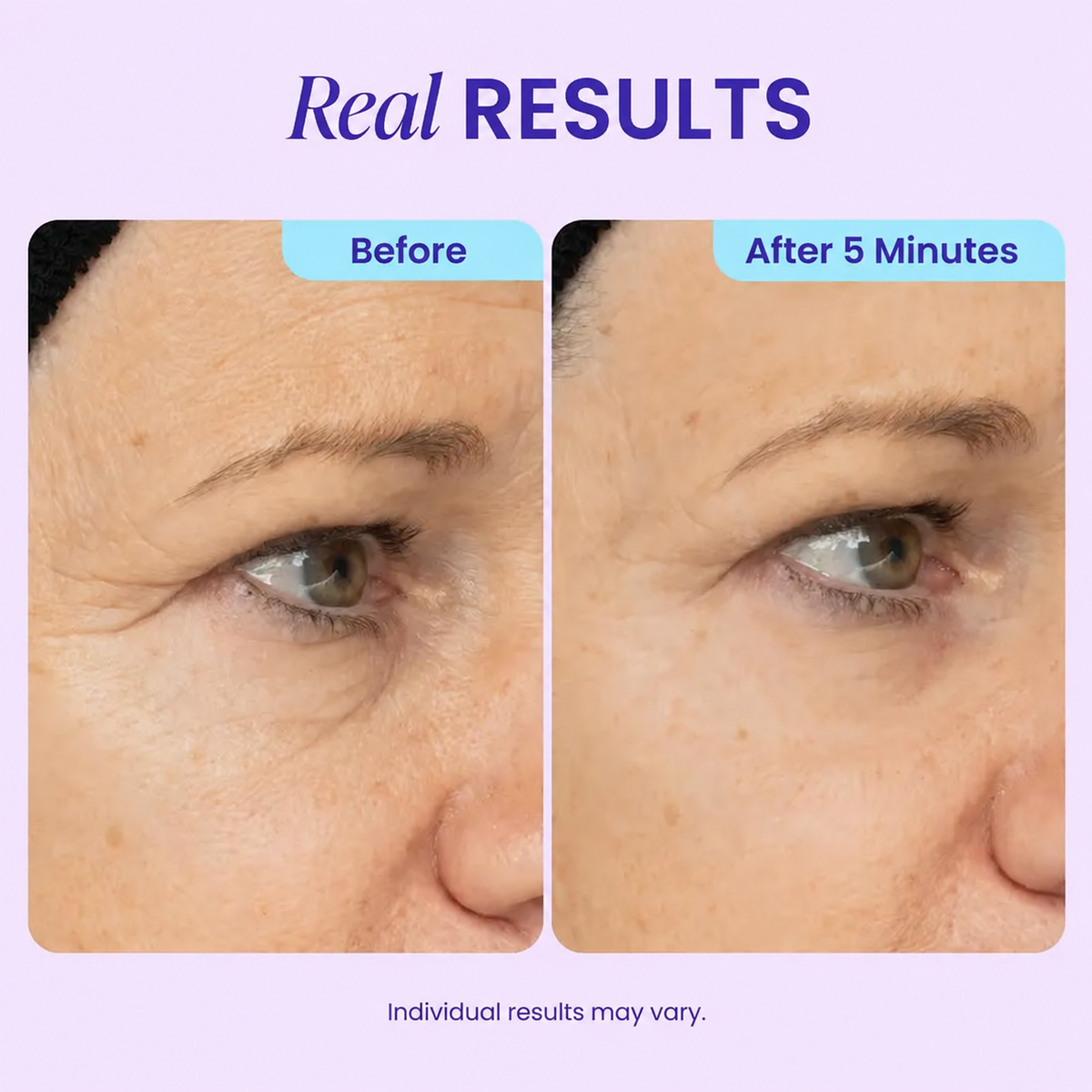 5-Minute Instant Eye Lift Gel – Smooth Fine Lines, Puffiness & Tired-Looking Eyes