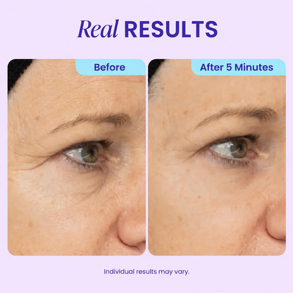 5-Minute Instant Eye Lift Gel – Smooth Fine Lines, Puffiness & Tired-Looking Eyes