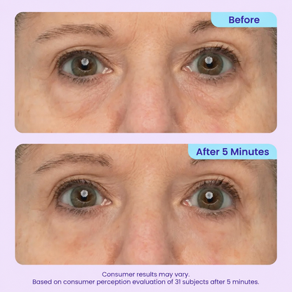 5-Minute Instant Eye Lift Gel – Smooth Fine Lines, Puffiness & Tired-Looking Eyes