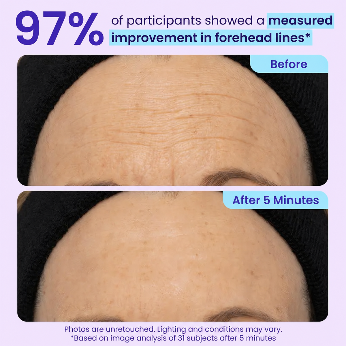 5-Minute Instant Eye Lift Gel – Smooth Fine Lines, Puffiness & Tired-Looking Eyes