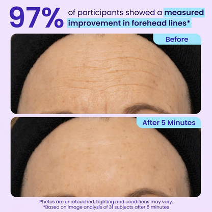 5-Minute Instant Eye Lift Gel – Smooth Fine Lines, Puffiness & Tired-Looking Eyes